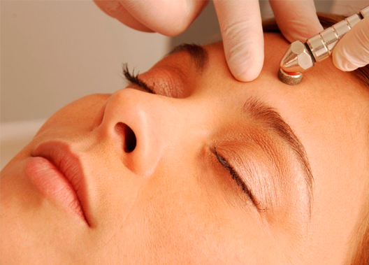 Microdermoabrasión con Punta de Diamanate :: Medicina Estética :: Central Clinic Sevilla