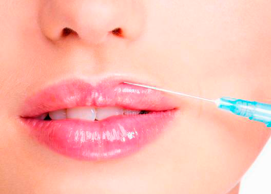 aumento_de_labios_en_sevilla_centralclinic_3 Aumento de labios en Sevilla :: Central Clinic :: Medicina Estética Sevilla